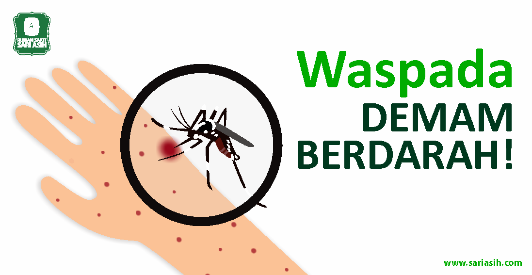 Hadapi lonjakan DBD, SAMES beli 10.000 alat tes dengue dari Korsel