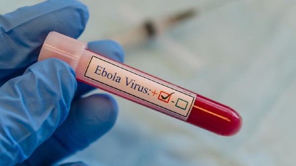 Badan kesehatan Afrika ingatkan sepuluh negara berisiko terkena wabah Ebola